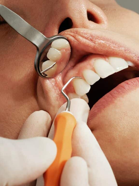 Quand devez-vous consulter un dentiste ?